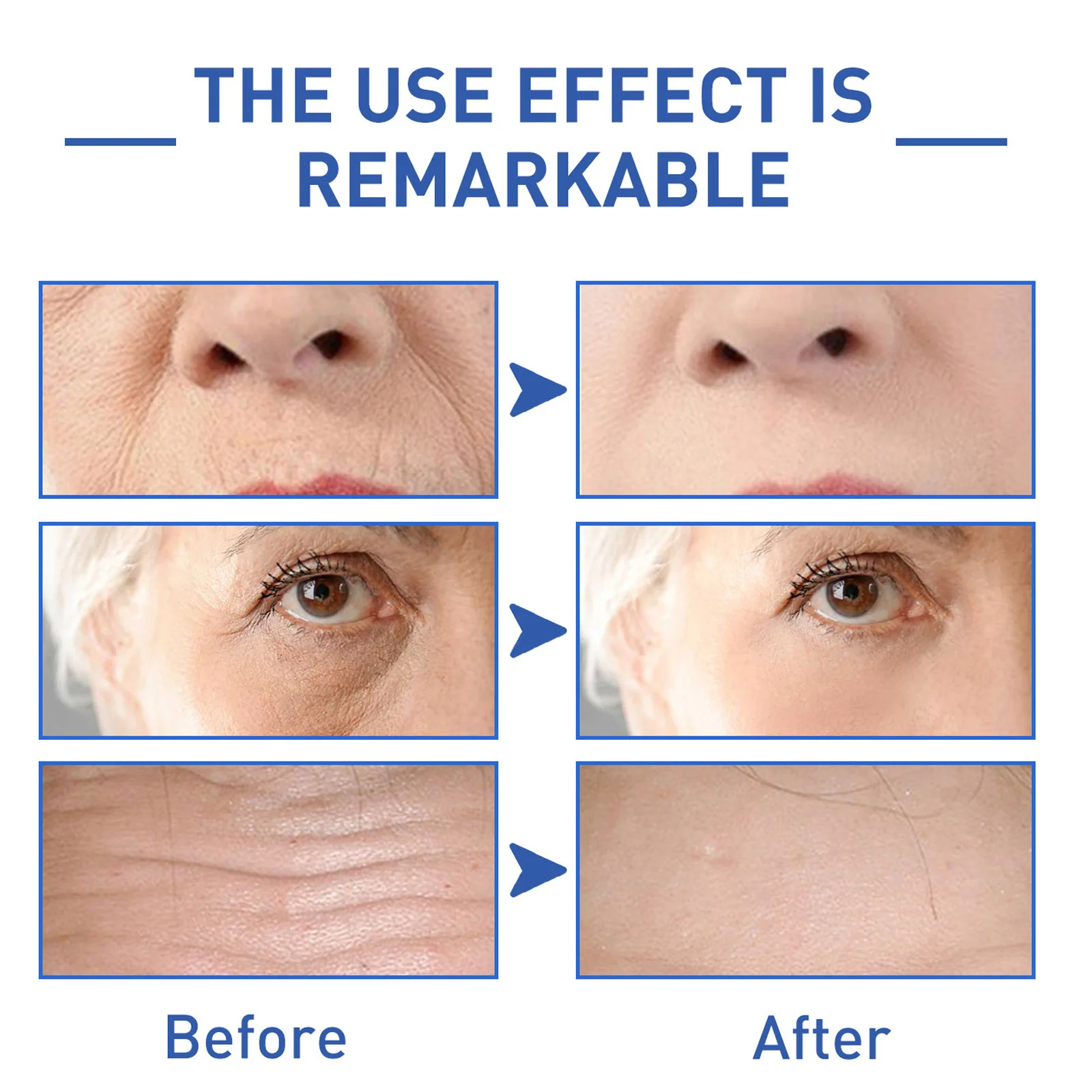 EELHOE-Anti-Wrinkle-Essence-Restore-Skin-Aging-Sagging-Collagen-Improve-Skin-Elasticity-Fade-Fine-Lines-Wrinkle.jpg_ (1)